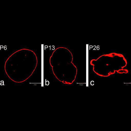  NCBI Organism:Homo sapiens; Cell Types:fibroblast Cell Components:nuclear envelope