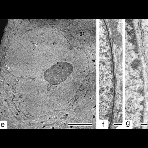  NCBI Organism:Homo sapiens; Cell Types:fibroblast Cell Components:nuclear envelope