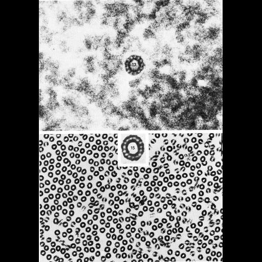  Cell Components:microtubule, microtubule-based flagellum part; Biological process:microtubule cytoskeleton organization