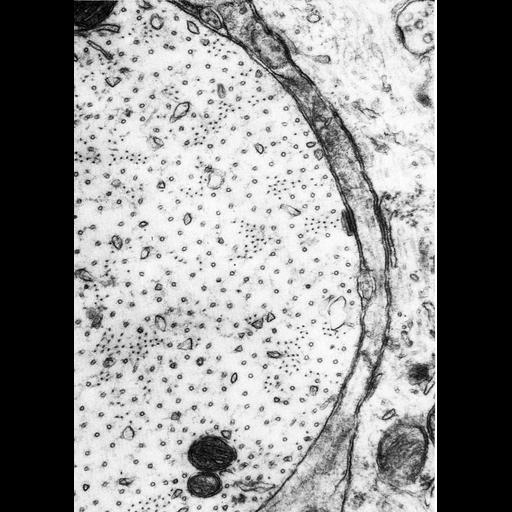  NCBI Organism:Vertebrata; Cell Types:CNS neuron (sensu Vertebrata) Cell Components:microtubule, dendrite cytoplasm, neurofilament; Biological process:microtubule cytoskeleton organization