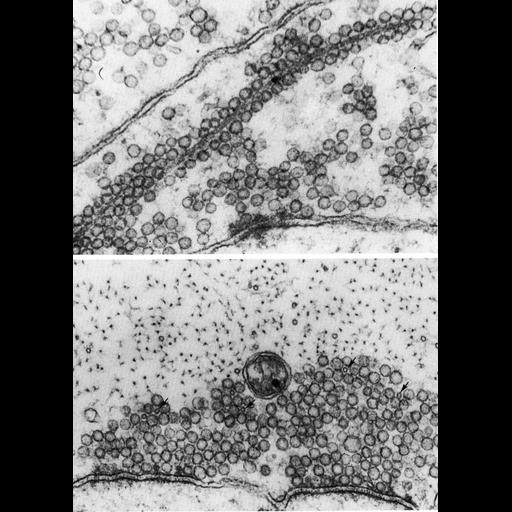  NCBI Organism:Petromyzon marinus; Cell Types:Mauthner neuron Cell Components:microtubule, giant axon, transport vesicle; Biological process:microtubule-based transport