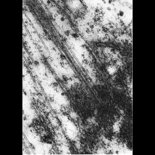  NCBI Organism:Pelomyxa; Cell Components:microtubule, condensed chromosome kinetochore; Biological process:mitosis, mitotic anaphase, attachment of spindle microtubules to chromosome;