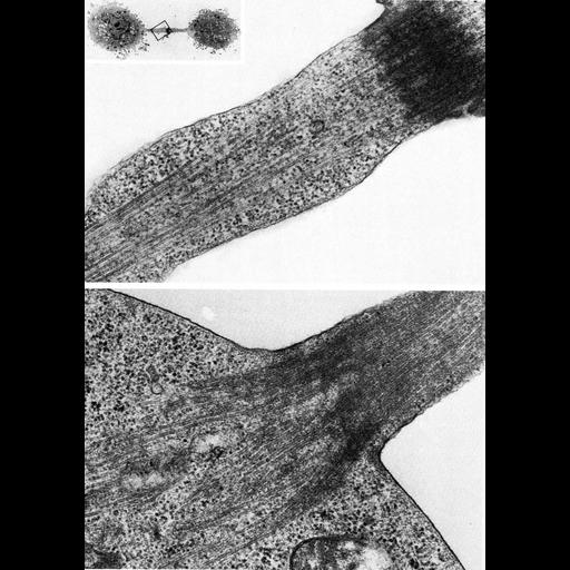  NCBI Organism:Homo sapiens, Cavia porcellus, ; Cell Types:erythroblast Cell Components:microtubule, spindle midzone; Biological process:mitotic telophase, mitosis;