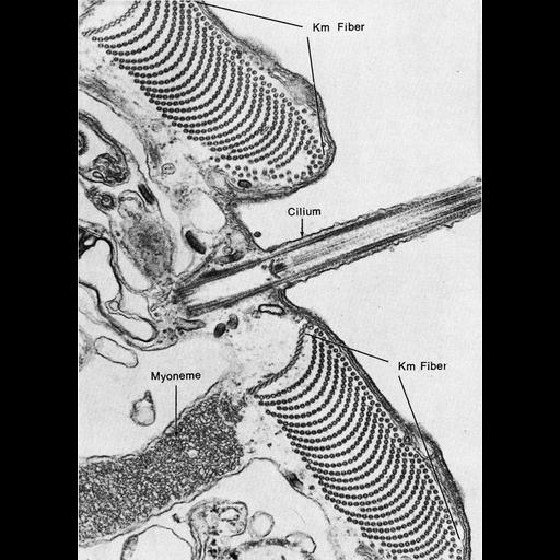  NCBI Organism:Stentor coeruleus; Cell Components:microtubule, cilium; Biological process:microtubule sliding, cilium movement involved in cell motility;