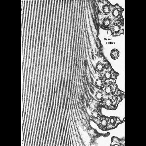  NCBI Organism:Stentor coeruleus; Cell Components:microtubule, cell cortex part, microtubule basal body, cilium; Biological process:microtubule sliding, cilium movement involved in cell motility;