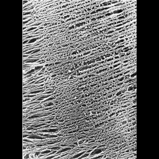  Cell Types:skeletal muscle cell Cell Components:actin filament, muscle thin filament tropomyosin, A band; Biological process:skeletal muscle contraction