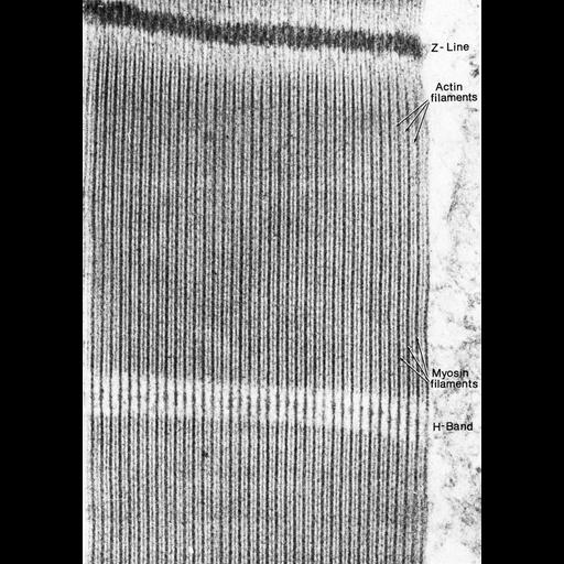  NCBI Organism:Drosophila melanogaster; Cell Types:flight muscle cell Cell Components:actin filament, muscle myosin complex, Z disc, I band, A band; Biological process:muscle contraction