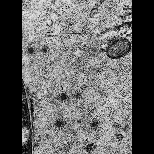  NCBI Organism:Mus musculus; Cell Types:smooth muscle cell Cell Components:actin filament, cytoplasm, ribosome; Biological process:smooth muscle contraction