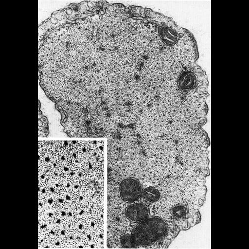  Cell Types:vascular associated smooth muscle cell Cell Components:actin filament, myosin filament, cytoplasm; Biological process:smooth muscle contraction