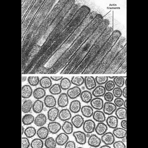  NCBI Organism:Felis catus; Cell Types:ciliated epithelial cell Cell Components:microvillus, actin filament, brush border; Biological process:intestinal absorption