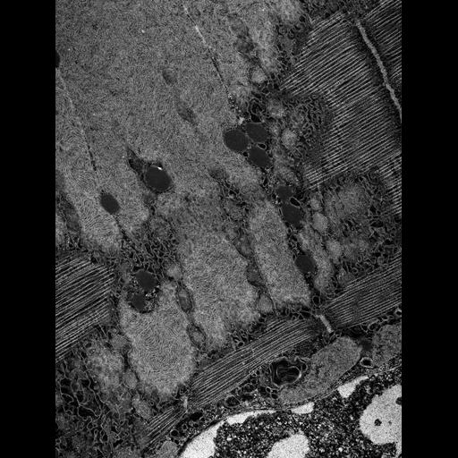  Cell Types:flight muscle cell Cell Components:myofibril, mitochondrion, sarcoplasmic reticulum, T-tubule; Biological process:skeletal muscle contraction, mitochondrial proton-transporting ATP synthase complex assembly, sequestering of calcium ion, membrane depolarization;