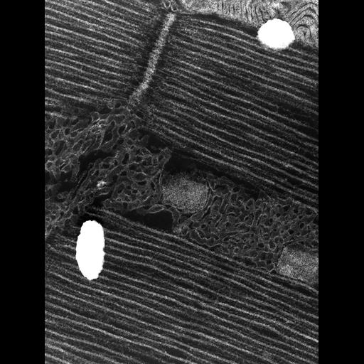  Cell Types:flight muscle cell Cell Components:myofibril, mitochondrion, sarcoplasmic reticulum, T-tubule; Biological process:skeletal muscle contraction, mitochondrial proton-transporting ATP synthase complex assembly, sequestering of calcium ion, membrane depolarization;