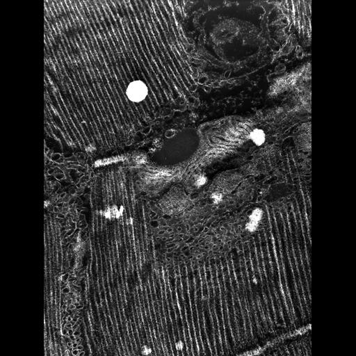  Cell Types:flight muscle cell Cell Components:myofibril, mitochondrion, sarcoplasmic reticulum, T-tubule; Biological process:skeletal muscle contraction, mitochondrial proton-transporting ATP synthase complex assembly, sequestering of calcium ion, membrane depolarization;