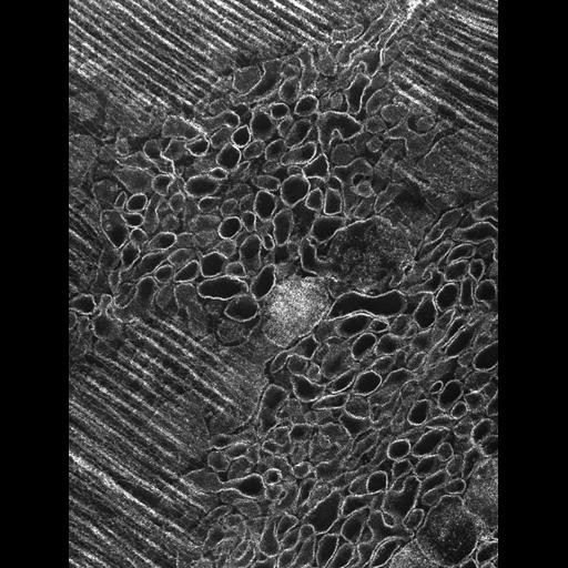  Cell Types:flight muscle cell Cell Components:myofibril, mitochondrion, sarcoplasmic reticulum, T-tubule; Biological process:skeletal muscle contraction, mitochondrial proton-transporting ATP synthase complex assembly, sequestering of calcium ion, membrane depolarization;