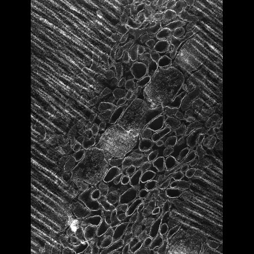  Cell Types:flight muscle cell Cell Components:myofibril, mitochondrion, sarcoplasmic reticulum, T-tubule; Biological process:skeletal muscle contraction, mitochondrial proton-transporting ATP synthase complex assembly, sequestering of calcium ion, membrane depolarization;