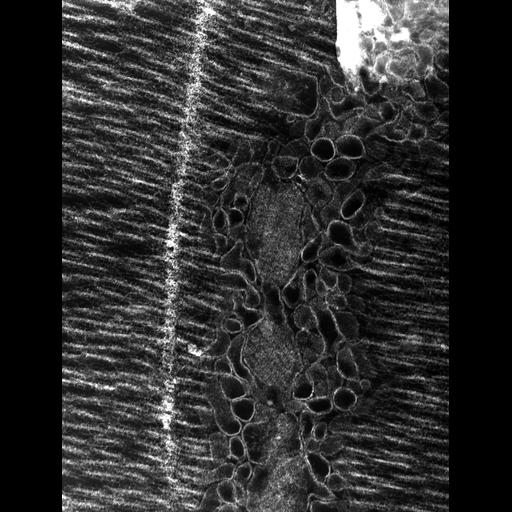  Cell Types:flight muscle cell Cell Components:myofibril, mitochondrion, sarcoplasmic reticulum, T-tubule; Biological process:skeletal muscle contraction, mitochondrial proton-transporting ATP synthase complex assembly, sequestering of calcium ion, membrane depolarization;