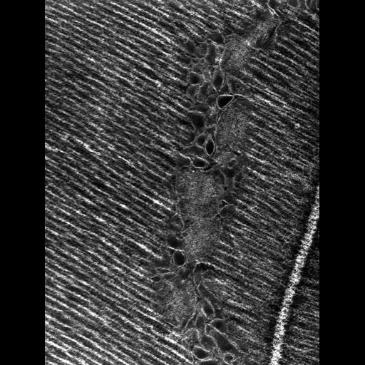  Cell Types:flight muscle cell Cell Components:myofibril, mitochondrion, sarcoplasmic reticulum, T-tubule; Biological process:skeletal muscle contraction, mitochondrial proton-transporting ATP synthase complex assembly, sequestering of calcium ion, membrane depolarization;