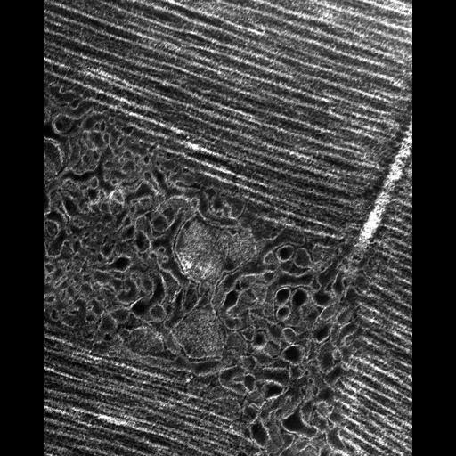  Cell Types:flight muscle cell Cell Components:myofibril, mitochondrion, sarcoplasmic reticulum, T-tubule; Biological process:skeletal muscle contraction, mitochondrial proton-transporting ATP synthase complex assembly, sequestering of calcium ion, membrane depolarization;