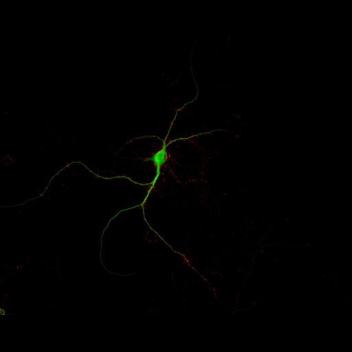  NCBI Organism:Rattus; Cell Types:multipolar neuron Cell Components:dendrite, microtubule cytoskeleton, synapse part, synaptic vesicle; Biological process:cellular developmental process, dendrite development, establishment or maintenance of cell polarity, synapse assembly, protein localization to synapse;