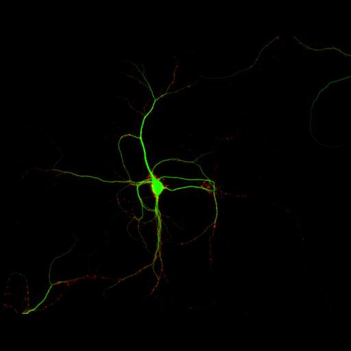  NCBI Organism:Rattus; Cell Types:multipolar neuron Cell Components:dendrite, microtubule cytoskeleton, synapse part, synaptic vesicle; Biological process:cellular developmental process, dendrite development, establishment or maintenance of cell polarity, synapse assembly, protein localization to synapse;