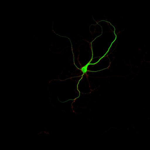  NCBI Organism:Rattus; Cell Types:multipolar neuron Cell Components:dendrite, microtubule cytoskeleton, synapse part, synaptic vesicle; Biological process:cellular developmental process, dendrite development, establishment or maintenance of cell polarity, synapse assembly, protein localization to synapse;