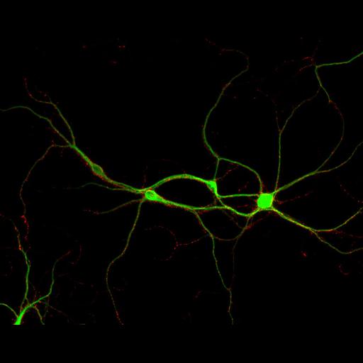  NCBI Organism:Rattus; Cell Types:multipolar neuron Cell Components:dendrite, microtubule cytoskeleton, synapse part, synaptic vesicle; Biological process:cellular developmental process, dendrite development, establishment or maintenance of cell polarity, synapse assembly, protein localization to synapse;