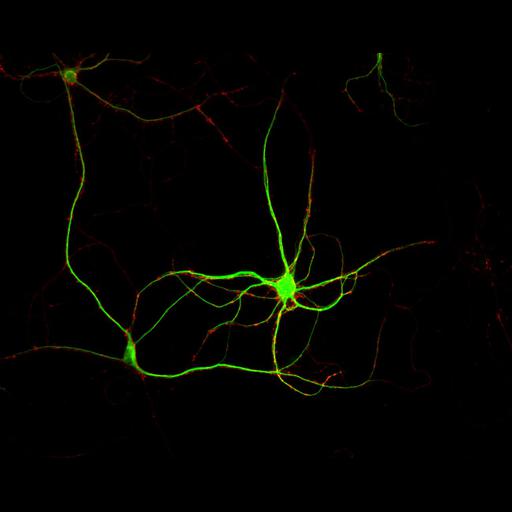  NCBI Organism:Rattus; Cell Types:multipolar neuron Cell Components:dendrite, microtubule cytoskeleton, synapse part, synaptic vesicle; Biological process:cellular developmental process, dendrite development, establishment or maintenance of cell polarity, synapse assembly, protein localization to synapse;