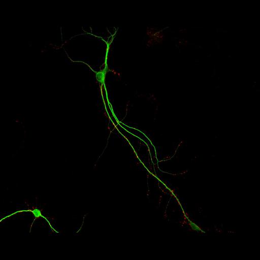  NCBI Organism:Rattus; Cell Types:multipolar neuron Cell Components:dendrite, microtubule cytoskeleton, synapse part, synaptic vesicle; Biological process:cellular developmental process, dendrite development, establishment or maintenance of cell polarity, synapse assembly, protein localization to synapse;