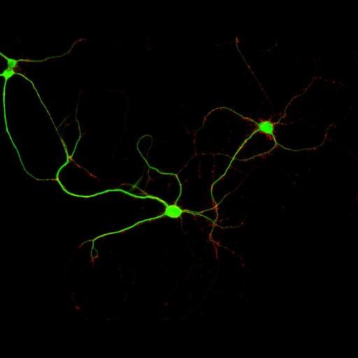  NCBI Organism:Rattus; Cell Types:multipolar neuron Cell Components:dendrite, microtubule cytoskeleton, synapse part, synaptic vesicle; Biological process:cellular developmental process, dendrite development, establishment or maintenance of cell polarity, synapse assembly, protein localization to synapse;