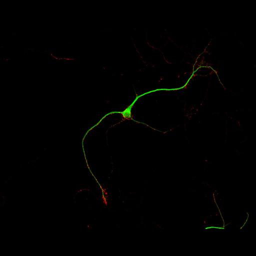  NCBI Organism:Rattus; Cell Types:multipolar neuron Cell Components:dendrite, microtubule cytoskeleton, synapse part, synaptic vesicle; Biological process:cellular developmental process, dendrite development, establishment or maintenance of cell polarity, synapse assembly, protein localization to synapse;