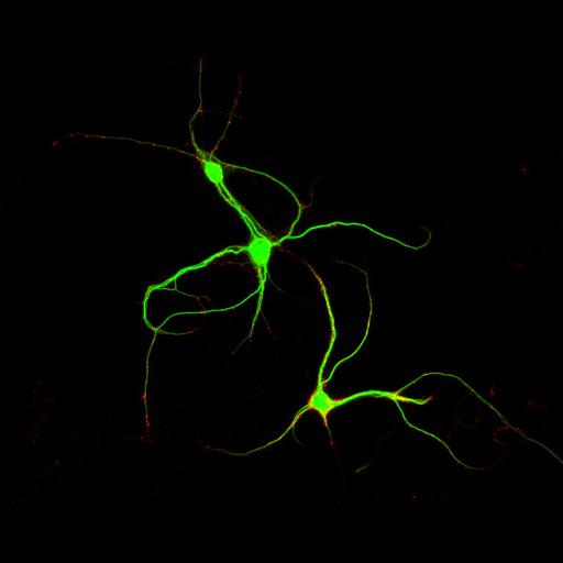  NCBI Organism:Rattus; Cell Types:multipolar neuron Cell Components:dendrite, microtubule cytoskeleton, synapse part, synaptic vesicle; Biological process:cellular developmental process, dendrite development, establishment or maintenance of cell polarity, synapse assembly, protein localization to synapse;