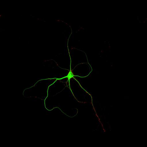  NCBI Organism:Rattus; Cell Types:multipolar neuron Cell Components:dendrite, microtubule cytoskeleton, synapse part, synaptic vesicle; Biological process:cellular developmental process, dendrite development, establishment or maintenance of cell polarity, synapse assembly, protein localization to synapse;