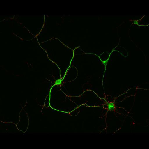  NCBI Organism:Rattus; Cell Types:multipolar neuron Cell Components:dendrite, microtubule cytoskeleton, synapse part, synaptic vesicle; Biological process:cellular developmental process, dendrite development, establishment or maintenance of cell polarity, synapse assembly, protein localization to synapse;