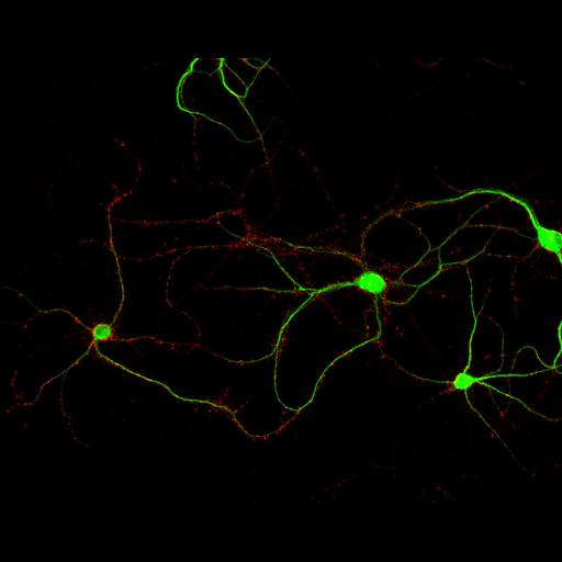  NCBI Organism:Rattus; Cell Types:multipolar neuron Cell Components:dendrite, microtubule cytoskeleton, synapse part, synaptic vesicle; Biological process:cellular developmental process, dendrite development, establishment or maintenance of cell polarity, synapse assembly, protein localization to synapse;