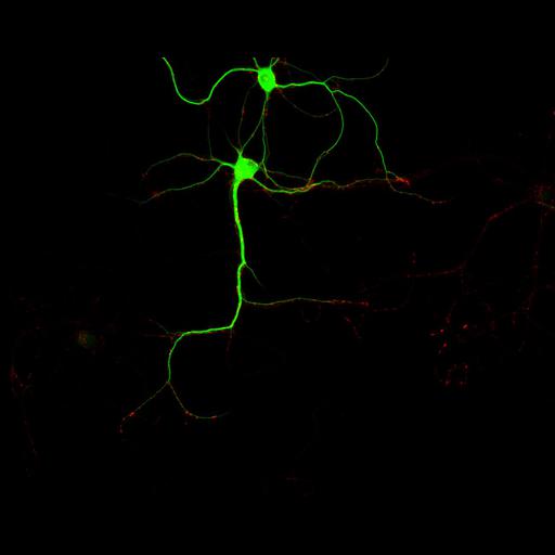  NCBI Organism:Rattus; Cell Types:multipolar neuron Cell Components:dendrite, microtubule cytoskeleton, synapse part, synaptic vesicle; Biological process:cellular developmental process, dendrite development, establishment or maintenance of cell polarity, synapse assembly, protein localization to synapse;