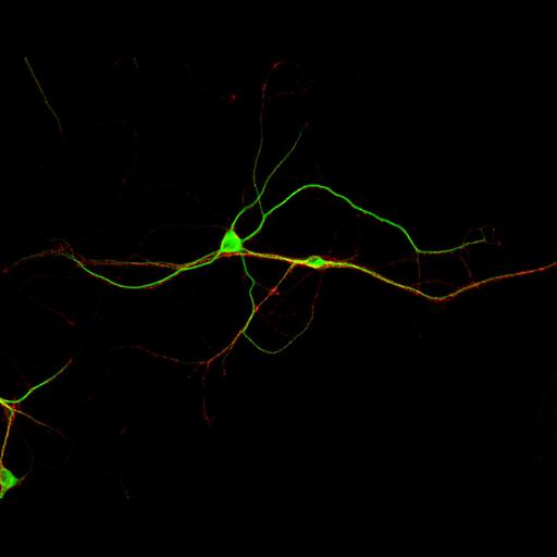  NCBI Organism:Rattus; Cell Types:multipolar neuron Cell Components:dendrite, microtubule cytoskeleton, synapse part, synaptic vesicle; Biological process:cellular developmental process, dendrite development, establishment or maintenance of cell polarity, synapse assembly, protein localization to synapse;