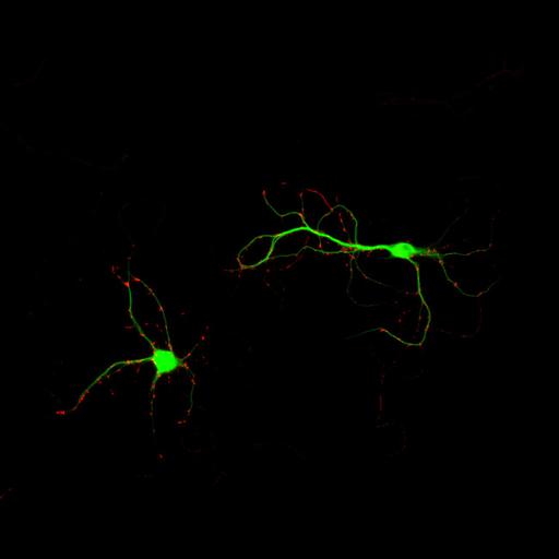  NCBI Organism:Rattus; Cell Types:multipolar neuron Cell Components:dendrite, microtubule cytoskeleton, synapse part, synaptic vesicle; Biological process:cellular developmental process, dendrite development, establishment or maintenance of cell polarity, synapse assembly, protein localization to synapse;