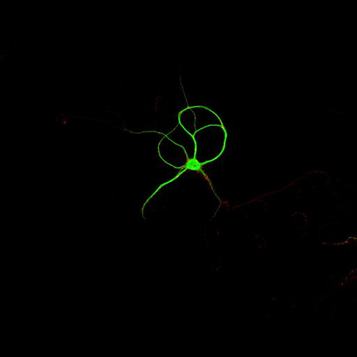  NCBI Organism:Rattus; Cell Types:multipolar neuron Cell Components:dendrite, microtubule cytoskeleton, synapse part, synaptic vesicle; Biological process:cellular developmental process, dendrite development, establishment or maintenance of cell polarity, synapse assembly, protein localization to synapse;