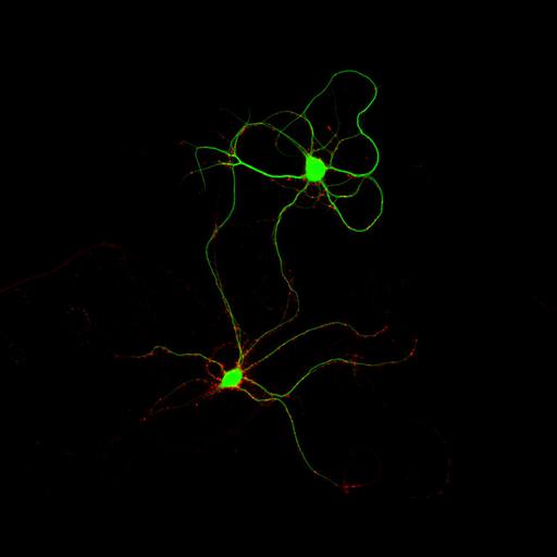  NCBI Organism:Rattus; Cell Types:multipolar neuron Cell Components:dendrite, microtubule cytoskeleton, synapse part, synaptic vesicle; Biological process:cellular developmental process, dendrite development, establishment or maintenance of cell polarity, synapse assembly, protein localization to synapse;