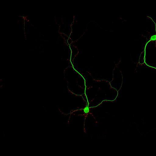  NCBI Organism:Rattus; Cell Types:multipolar neuron Cell Components:dendrite, microtubule cytoskeleton, synapse part, synaptic vesicle; Biological process:cellular developmental process, dendrite development, establishment or maintenance of cell polarity, synapse assembly, protein localization to synapse;