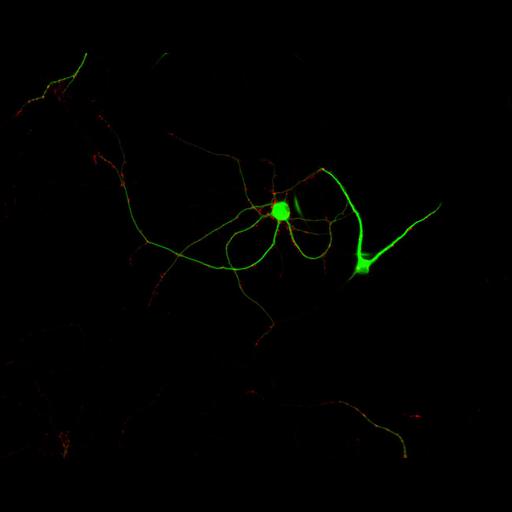  NCBI Organism:Rattus; Cell Types:multipolar neuron Cell Components:dendrite, microtubule cytoskeleton, synapse part, synaptic vesicle; Biological process:cellular developmental process, dendrite development, establishment or maintenance of cell polarity, synapse assembly, protein localization to synapse;