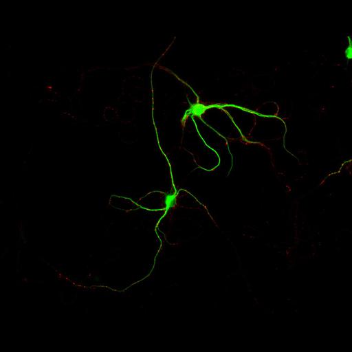  NCBI Organism:Rattus; Cell Types:multipolar neuron Cell Components:dendrite, microtubule cytoskeleton, synapse part, synaptic vesicle; Biological process:cellular developmental process, dendrite development, establishment or maintenance of cell polarity, synapse assembly, protein localization to synapse;