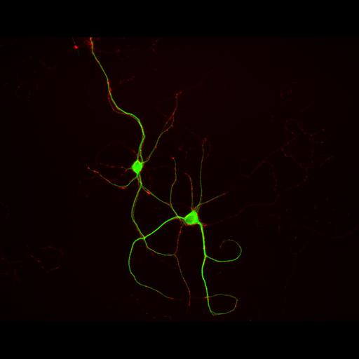  NCBI Organism:Rattus; Cell Types:multipolar neuron Cell Components:dendrite, microtubule cytoskeleton, synapse part, synaptic vesicle; Biological process:cellular developmental process, dendrite development, establishment or maintenance of cell polarity, synapse assembly, protein localization to synapse;