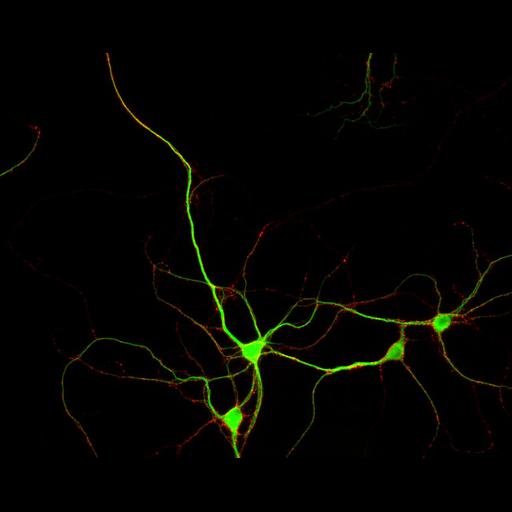  NCBI Organism:Rattus; Cell Types:multipolar neuron Cell Components:dendrite, microtubule cytoskeleton, synapse part, synaptic vesicle; Biological process:cellular developmental process, dendrite development, establishment or maintenance of cell polarity, synapse assembly, protein localization to synapse;