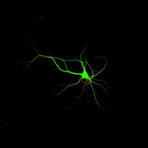  NCBI Organism:Rattus; Cell Types:multipolar neuron Cell Components:dendrite, microtubule cytoskeleton, synapse part, synaptic vesicle; Biological process:cellular developmental process, dendrite development, establishment or maintenance of cell polarity, synapse assembly, protein localization to synapse;