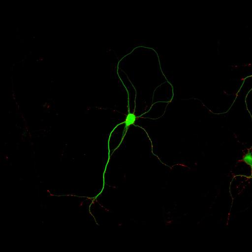  NCBI Organism:Rattus; Cell Types:multipolar neuron Cell Components:dendrite, microtubule cytoskeleton, synapse part, synaptic vesicle; Biological process:cellular developmental process, dendrite development, establishment or maintenance of cell polarity, synapse assembly, protein localization to synapse;