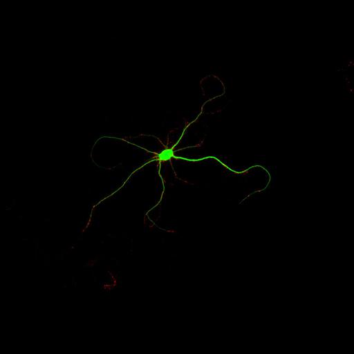  NCBI Organism:Rattus; Cell Types:multipolar neuron Cell Components:dendrite, microtubule cytoskeleton, synapse part, synaptic vesicle; Biological process:cellular developmental process, dendrite development, establishment or maintenance of cell polarity, synapse assembly, protein localization to synapse;