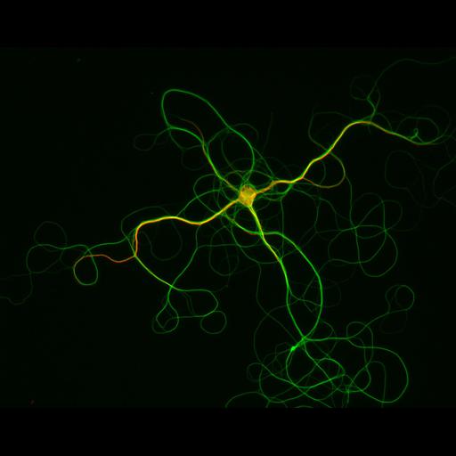  NCBI Organism:Rattus; Cell Types:multipolar neuron Cell Components:dendrite, microtubule cytoskeleton, axon, synaptic vesicle; Biological process:cellular developmental process, dendrite development, establishment or maintenance of cell polarity, establishment or maintenance of microtubule cytoskeleton polarity;