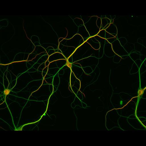  NCBI Organism:Rattus; Cell Types:multipolar neuron Cell Components:dendrite, microtubule cytoskeleton, axon, synaptic vesicle; Biological process:cellular developmental process, dendrite development, establishment or maintenance of cell polarity, establishment or maintenance of microtubule cytoskeleton polarity;