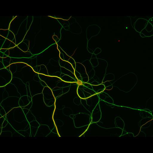  NCBI Organism:Rattus; Cell Types:multipolar neuron Cell Components:dendrite, microtubule cytoskeleton, axon, synaptic vesicle; Biological process:cellular developmental process, dendrite development, establishment or maintenance of cell polarity, establishment or maintenance of microtubule cytoskeleton polarity;